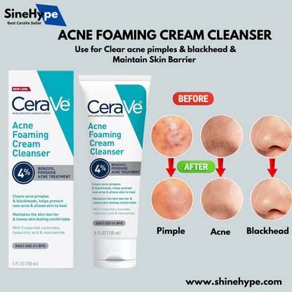 Acne Foaming Cream Cleanser 150ml